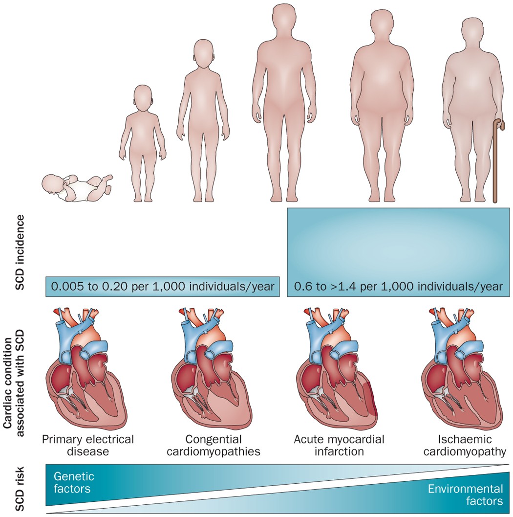 Genetics of sudden cardiac death caused by ventricular arrhythmias | Nature  Reviews Cardiology
