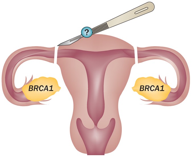 Ooforectomia bilateral.  Download Scientific Diagram