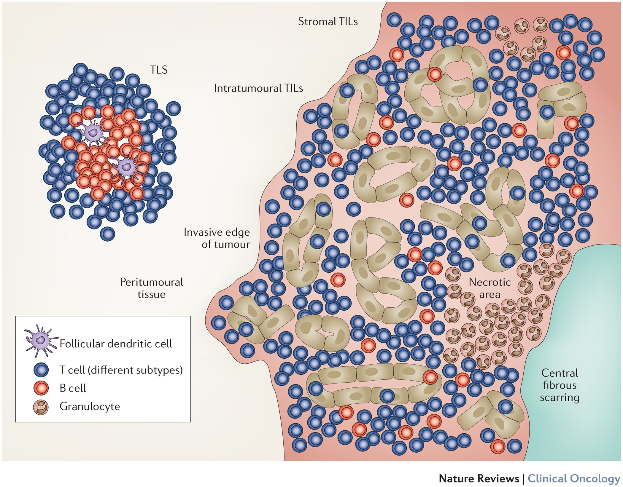 Clinical relevance host immunity in cancer: from TILs to the | Nature Reviews Clinical