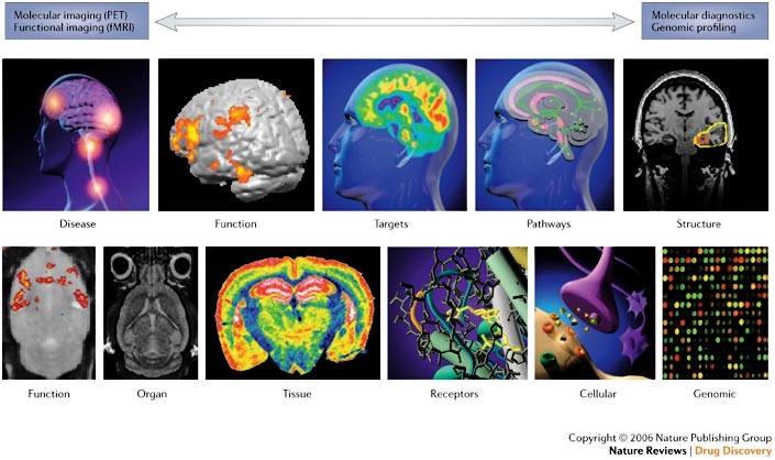 Brain imaging tests for chronic pain: medical, legal and ethical