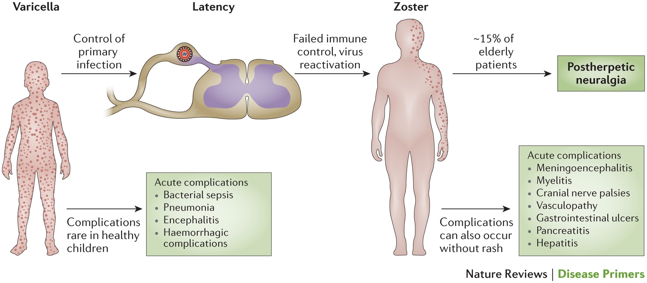 Varicella zoster virus infection | Nature Reviews Disease Primers