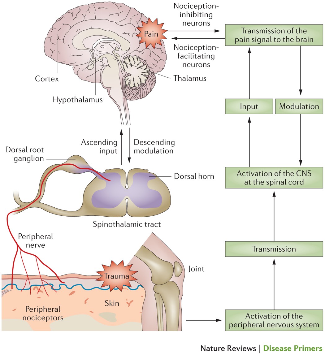 Fibromyalgia notable studies - MEpedia