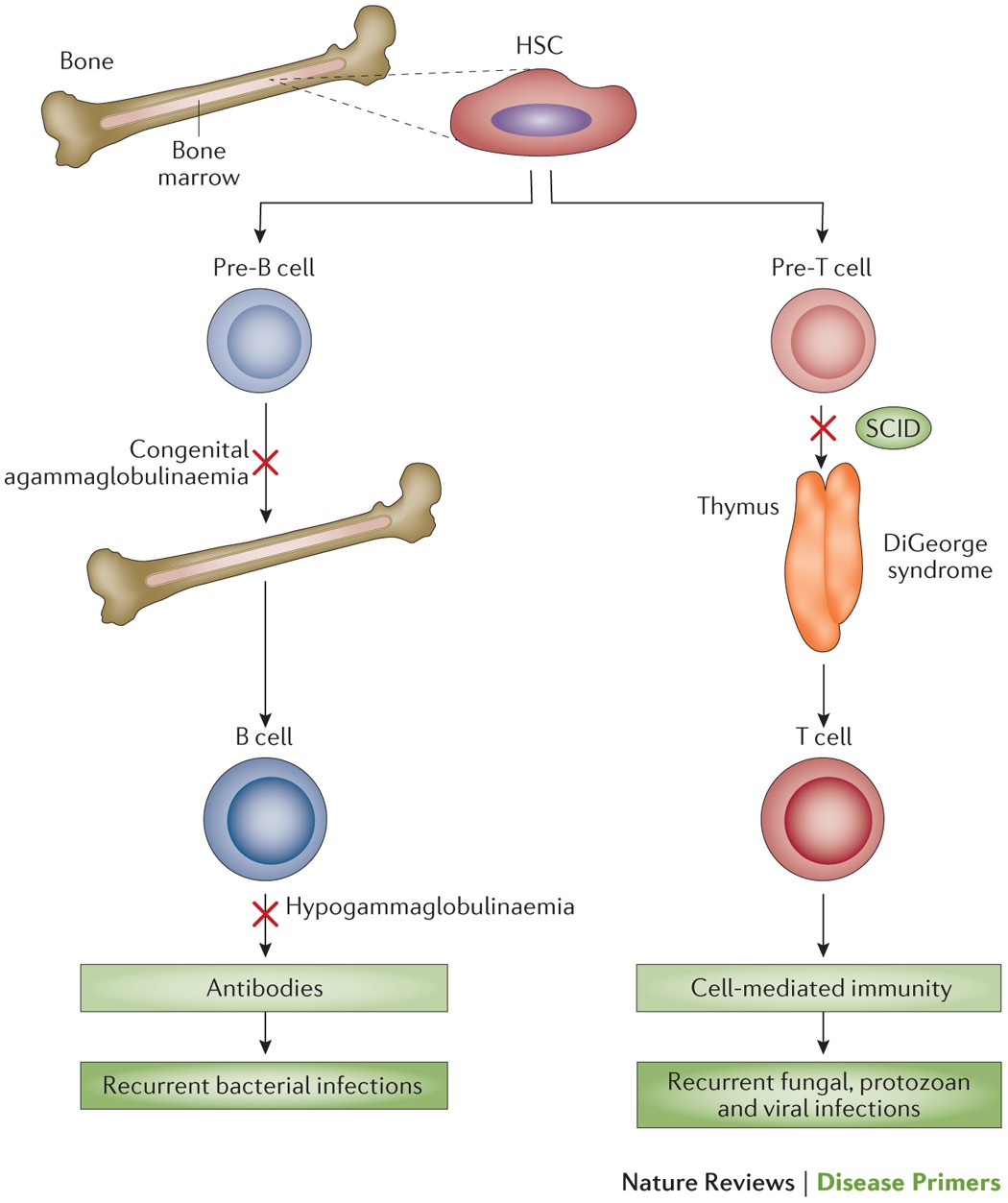 Severe combined immunodeficiencies and related disorders | Nature Reviews  Disease Primers