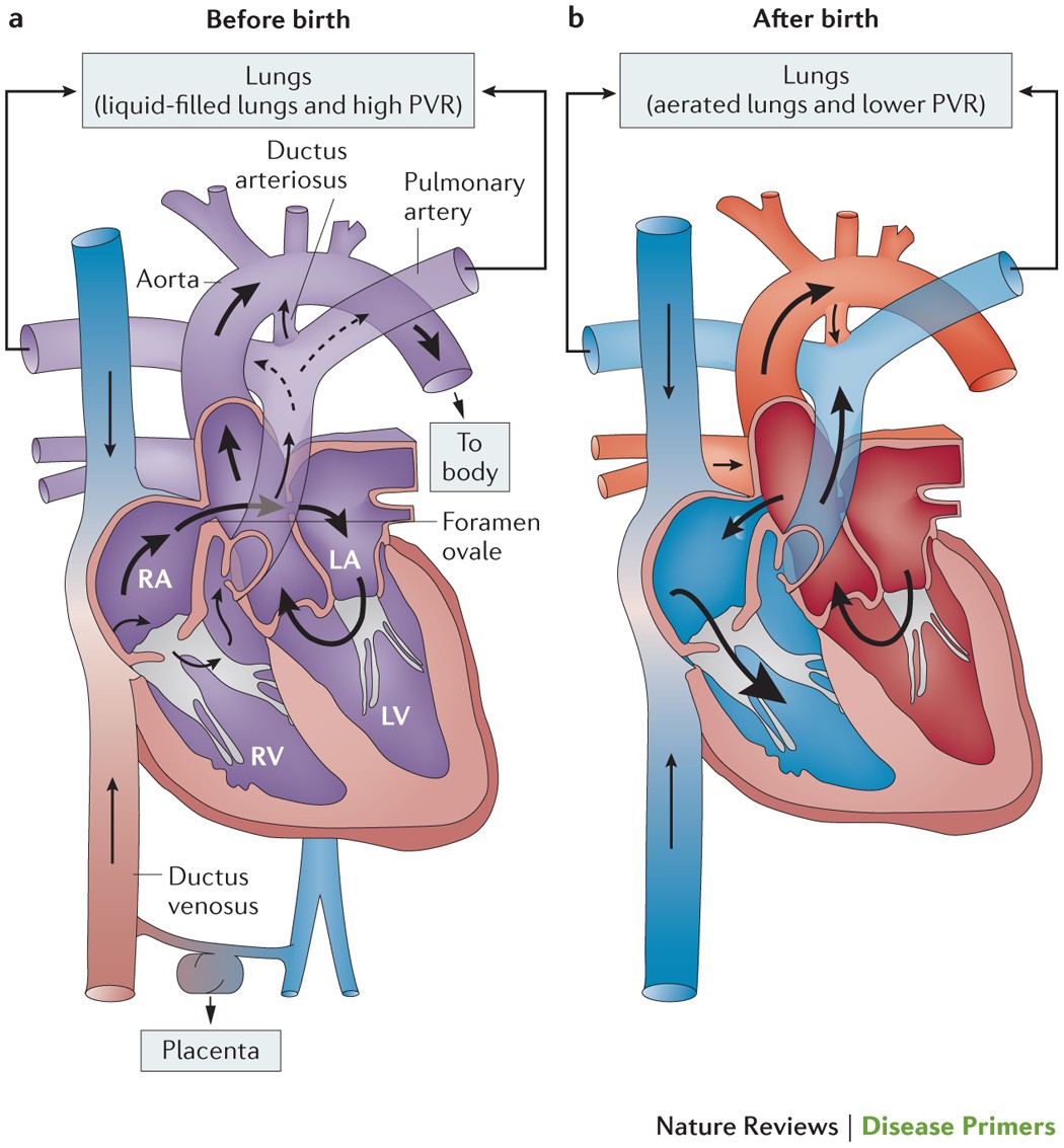 Foramen ovale