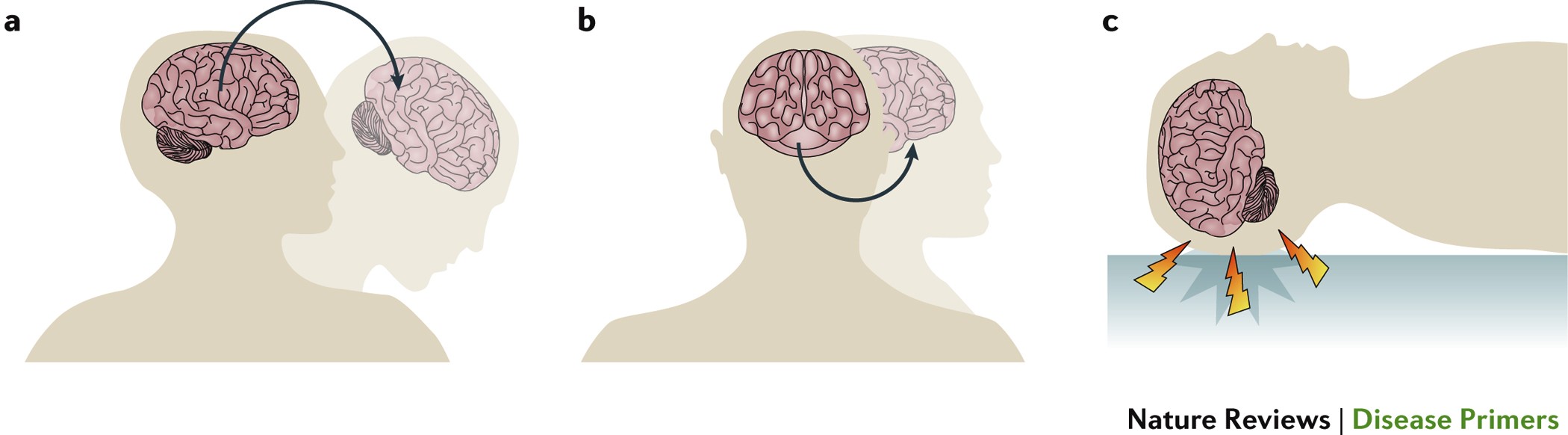 Long-term Multidomain Patterns of Change After Traumatic Brain Injury