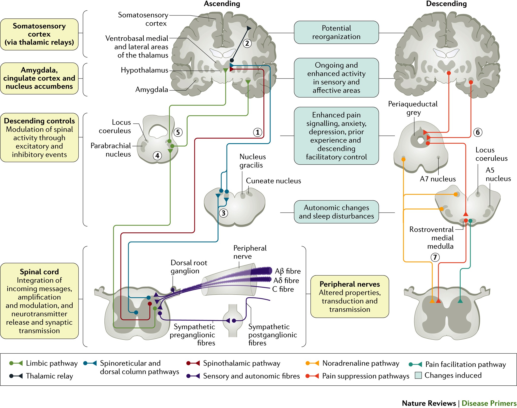 Neuropathic Pain Nature Reviews Disease Primers
