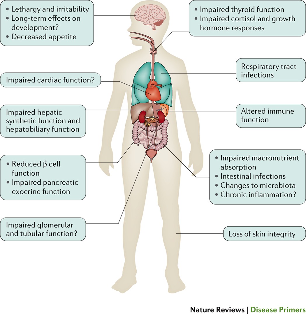 causes and effects of malnutrition