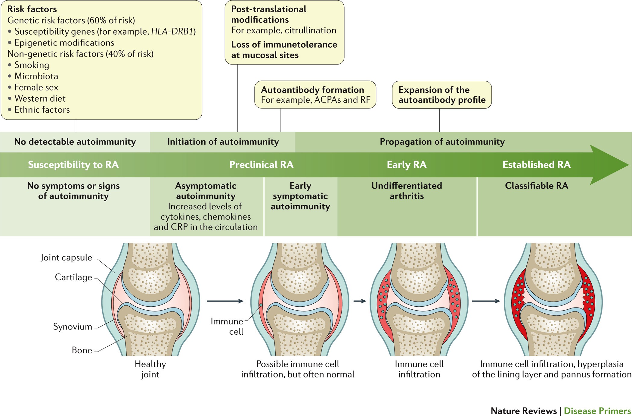 Rheumatoid Arthritis Chart