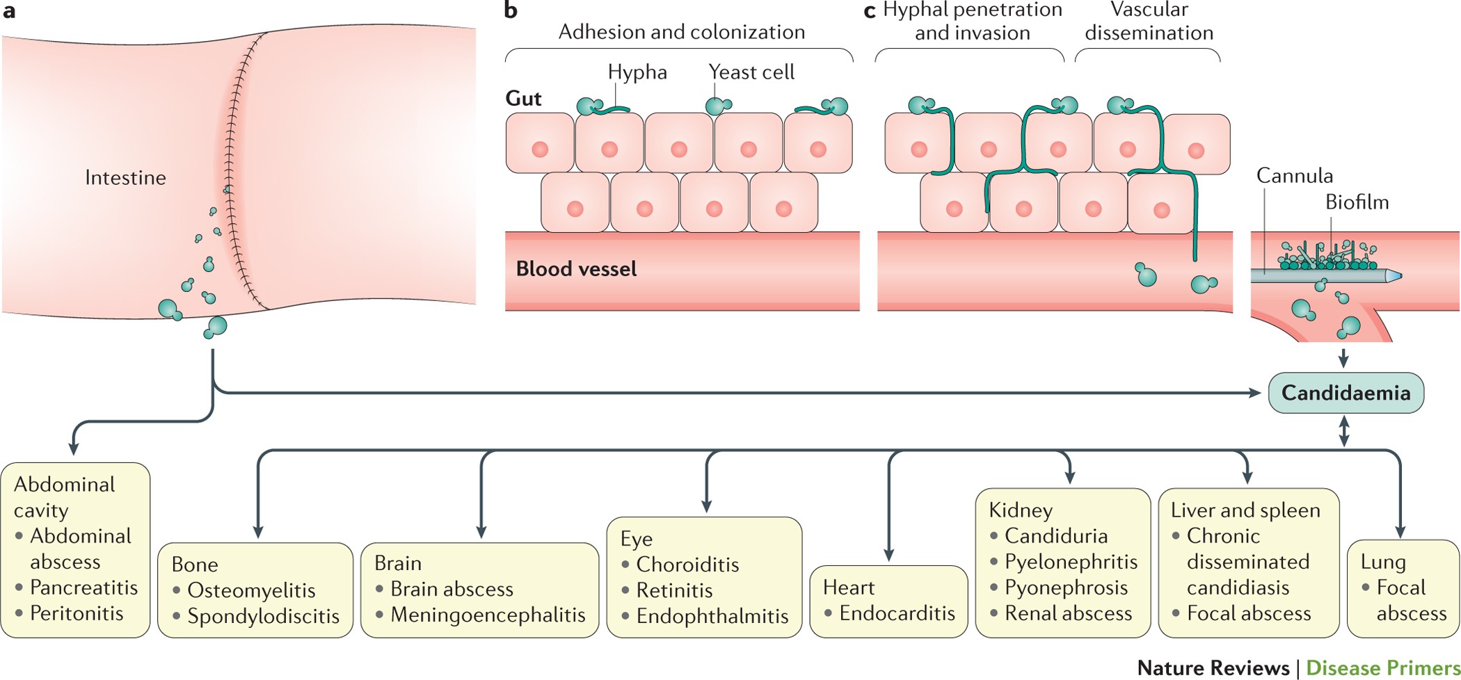 Invasive Candidiasis Nature Reviews Disease Primers
