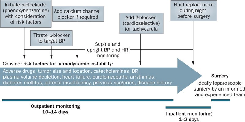 View of Surgical and Pharmacological Management of Functioning  Pheochromocytoma and Paraganglioma