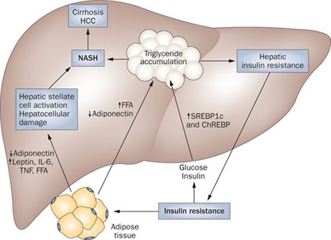 Nonalcoholic fatty liver disease and diabetes mellitus: pathogenesis and  treatment | Nature Reviews Endocrinology