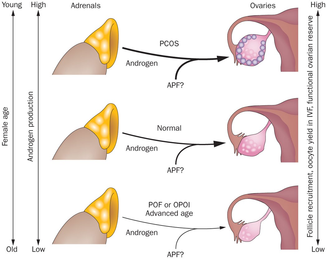 Endocrine autoimmune diseases and female infertility | Nature Reviews  Endocrinology