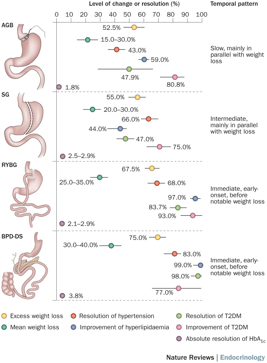 Bariatric Surgery Comparison Chart