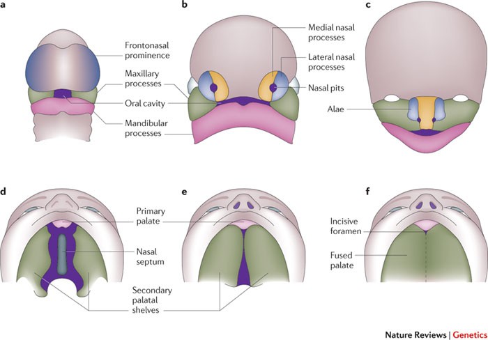 Cleft lip palate: understanding genetic and environmental influences | Nature Genetics