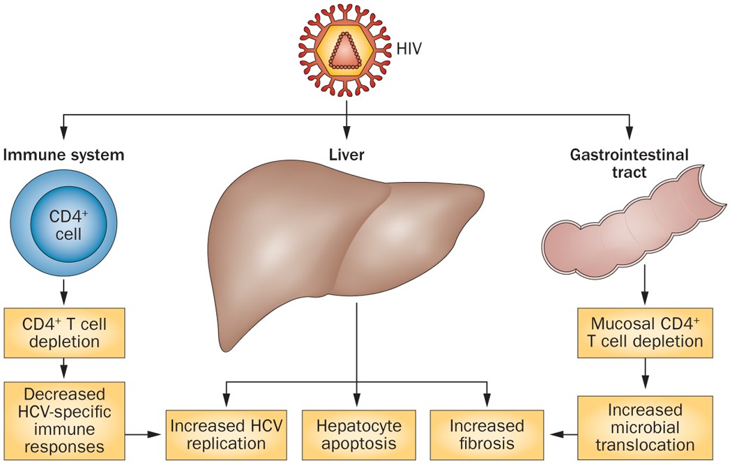 HCV and HIV co-infection: mechanisms and management | Nature Reviews  Gastroenterology & Hepatology