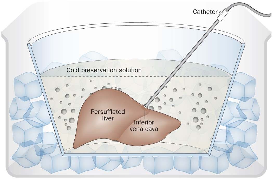 glutathione white blood cells Increased Levels of Oxidized Glutathione in CD4+ Lymphocytes Associated  With Disturbed Intracellular Redox Balance in Human Immunodeficiency Virus  Type 1 Infection