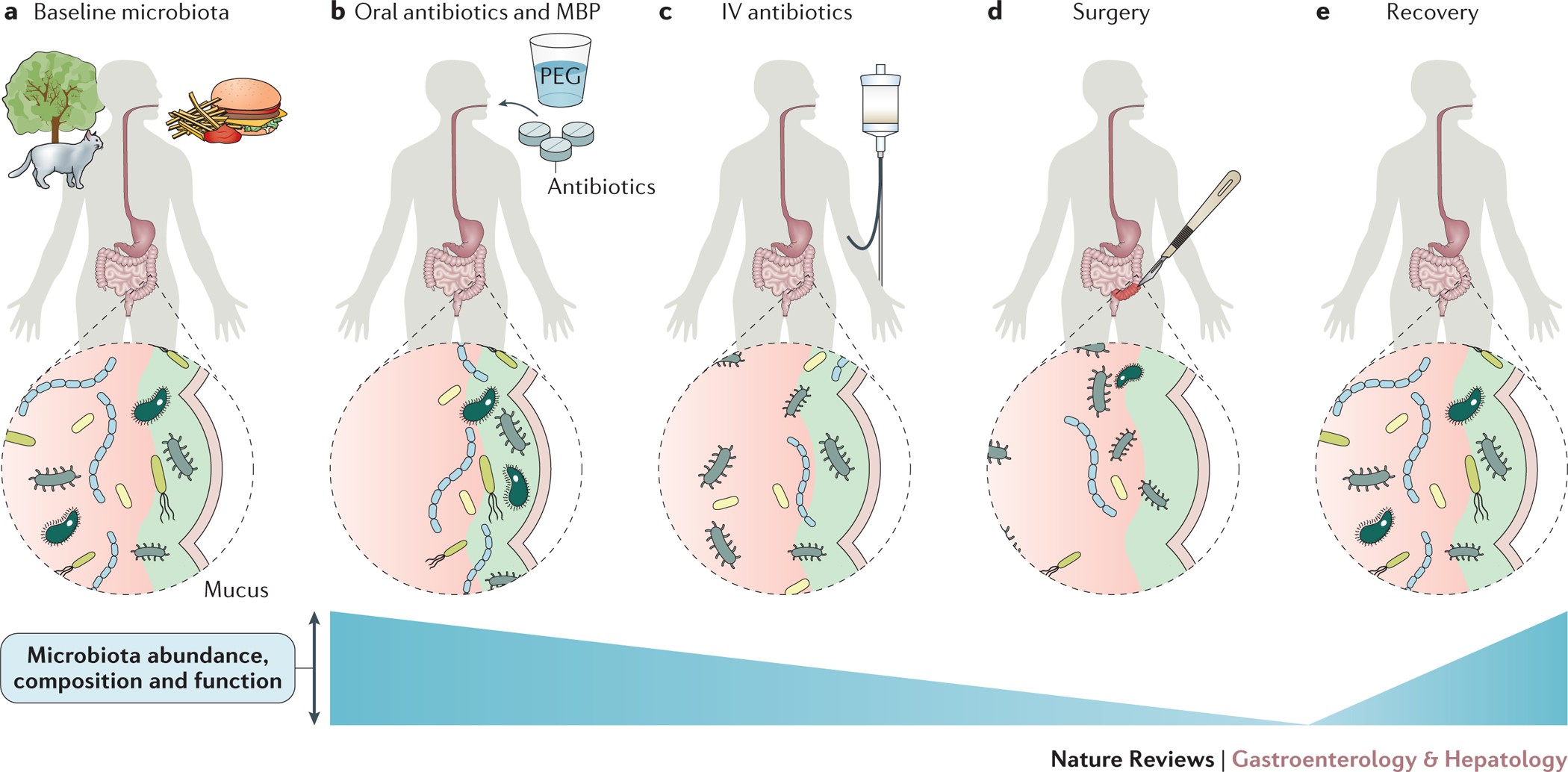 The gut microbiota gastrointestinal surgery | Nature Reviews Gastroenterology &