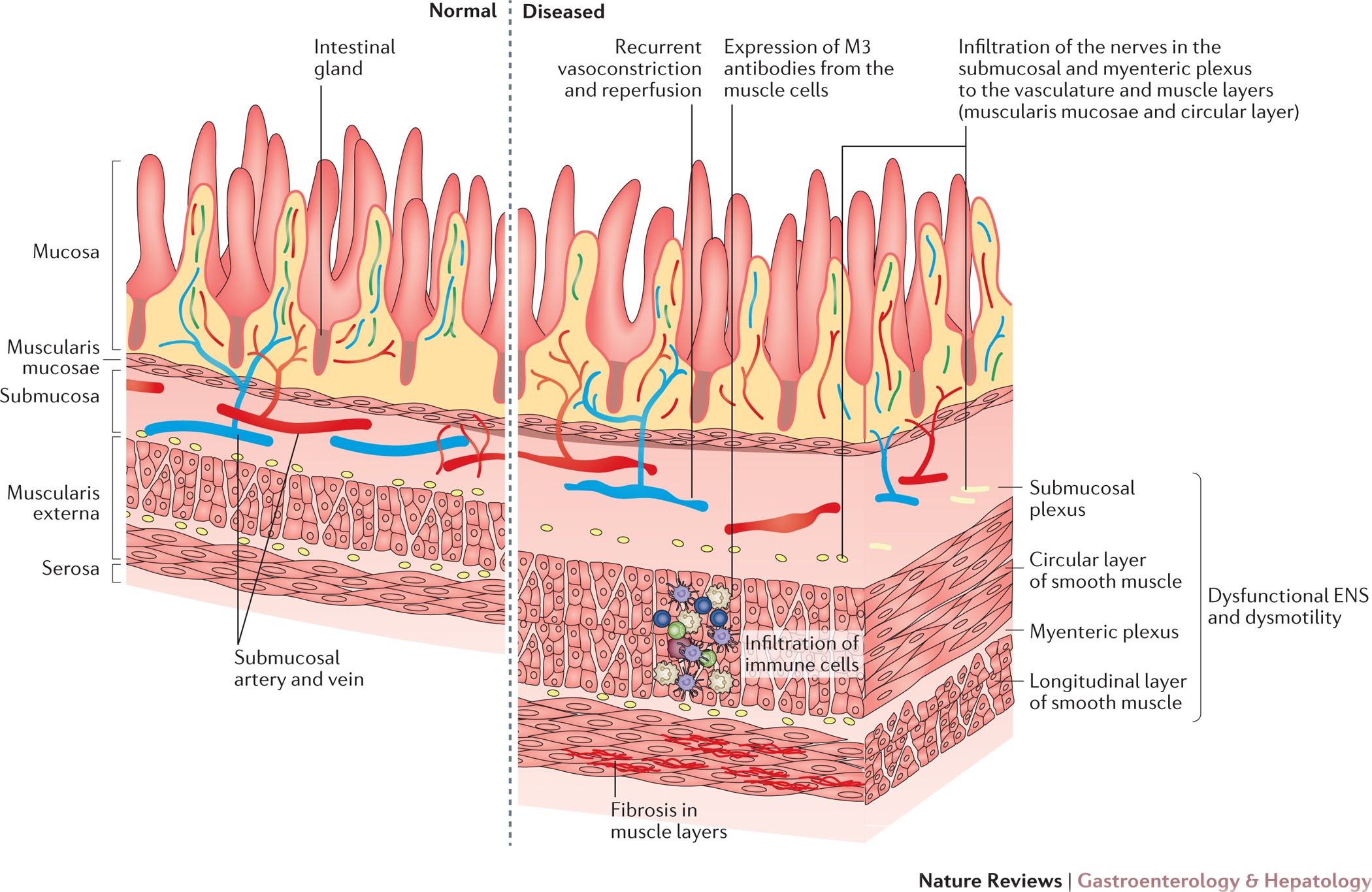 Gastrointestinal Myoelectrical Activity in Idiopathic Intestinal  Pseudo-Obstruction