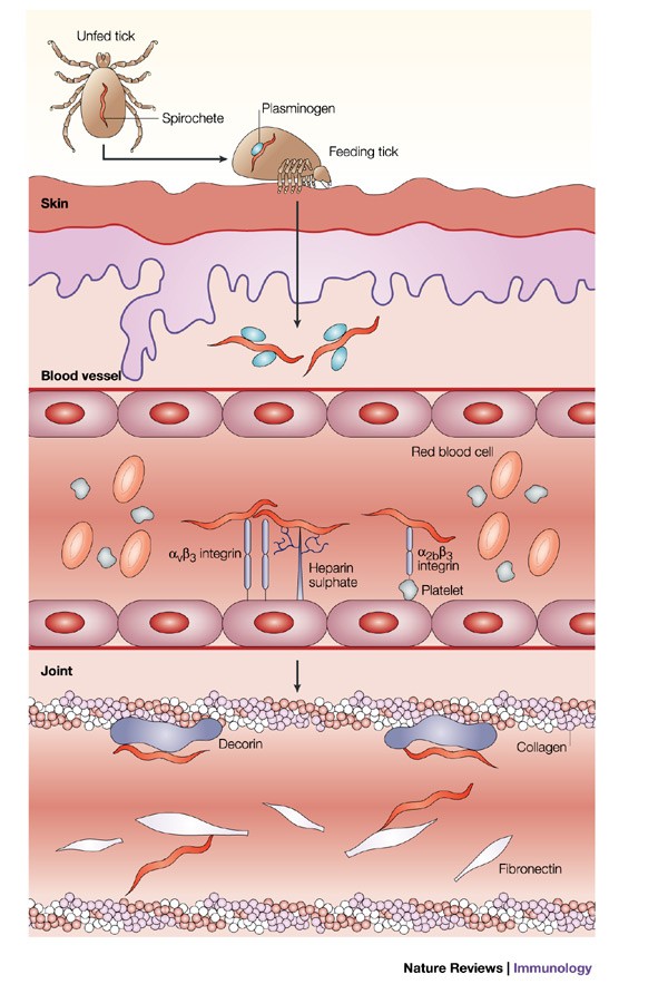 l-glutathione lyme disease Elucidation of Lyme arthritis