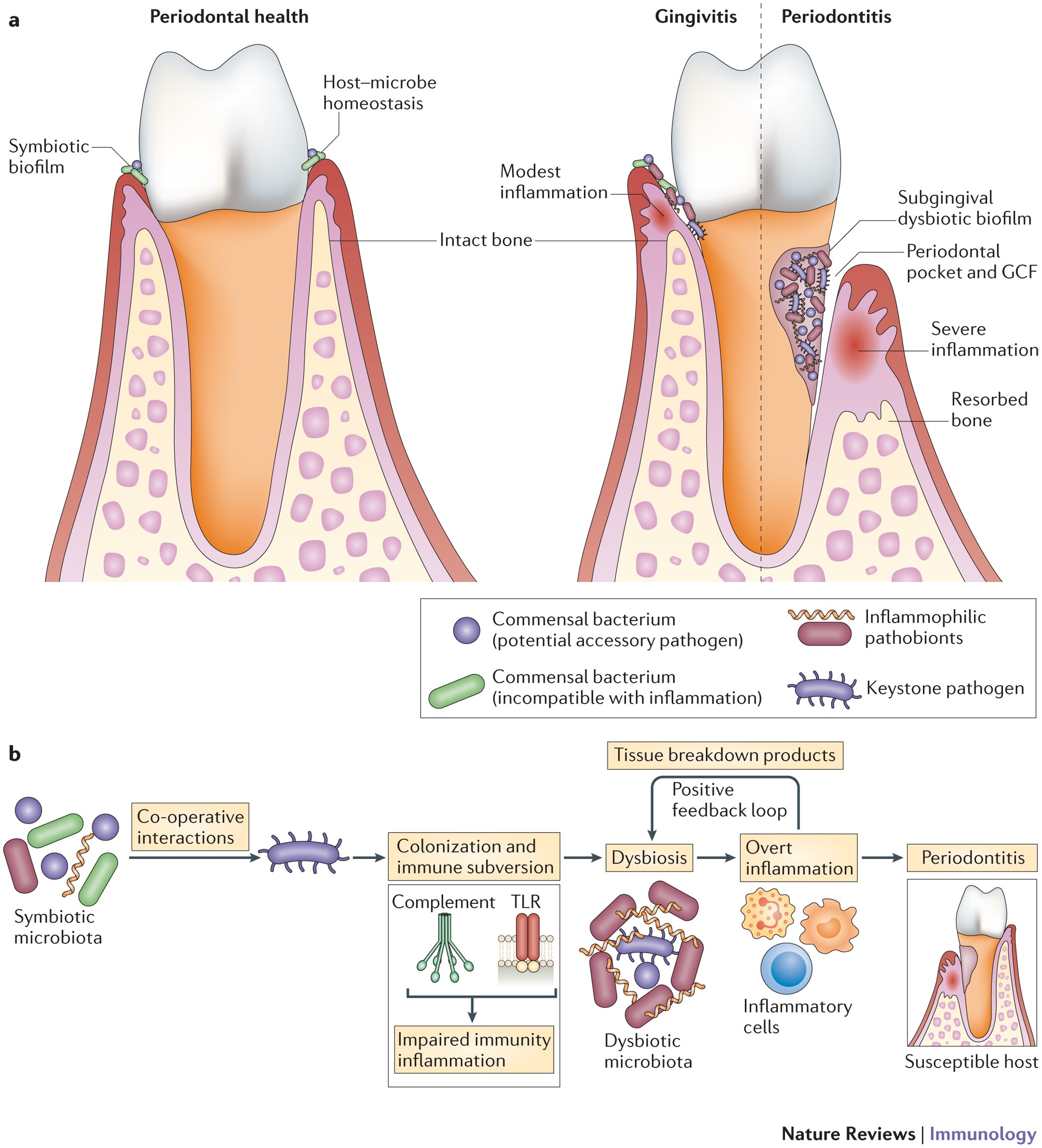 Nature Reviews Immunology - Periodontitis has been linked to systemic infla...