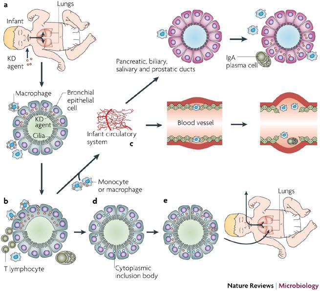 Searching for cause of Kawasaki disease — cytoplasmic provide new insight | Nature Reviews Microbiology