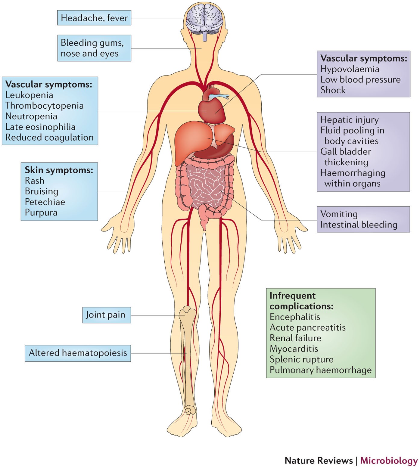 Barriers preclinical of anti-dengue immunity and dengue Nature Reviews Microbiology