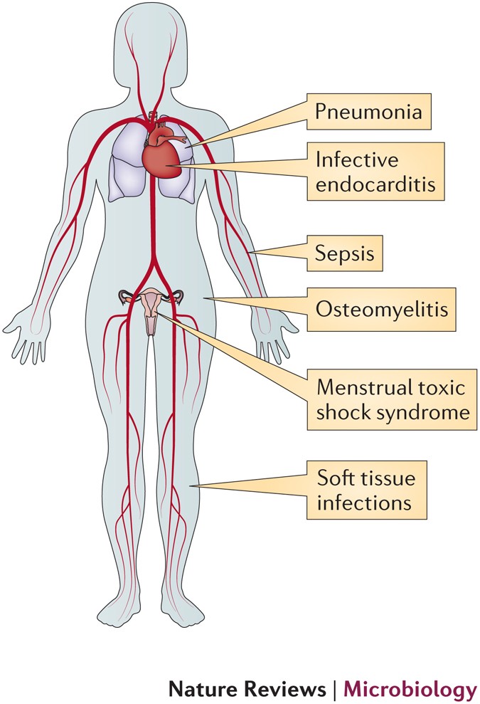 minor staphylococcus infection