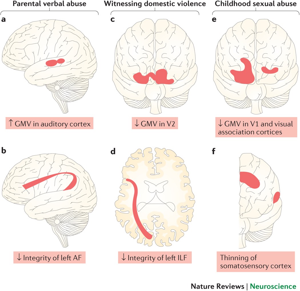 The effects of childhood maltreatment on brain structure, function and  connectivity | Nature Reviews Neuroscience
