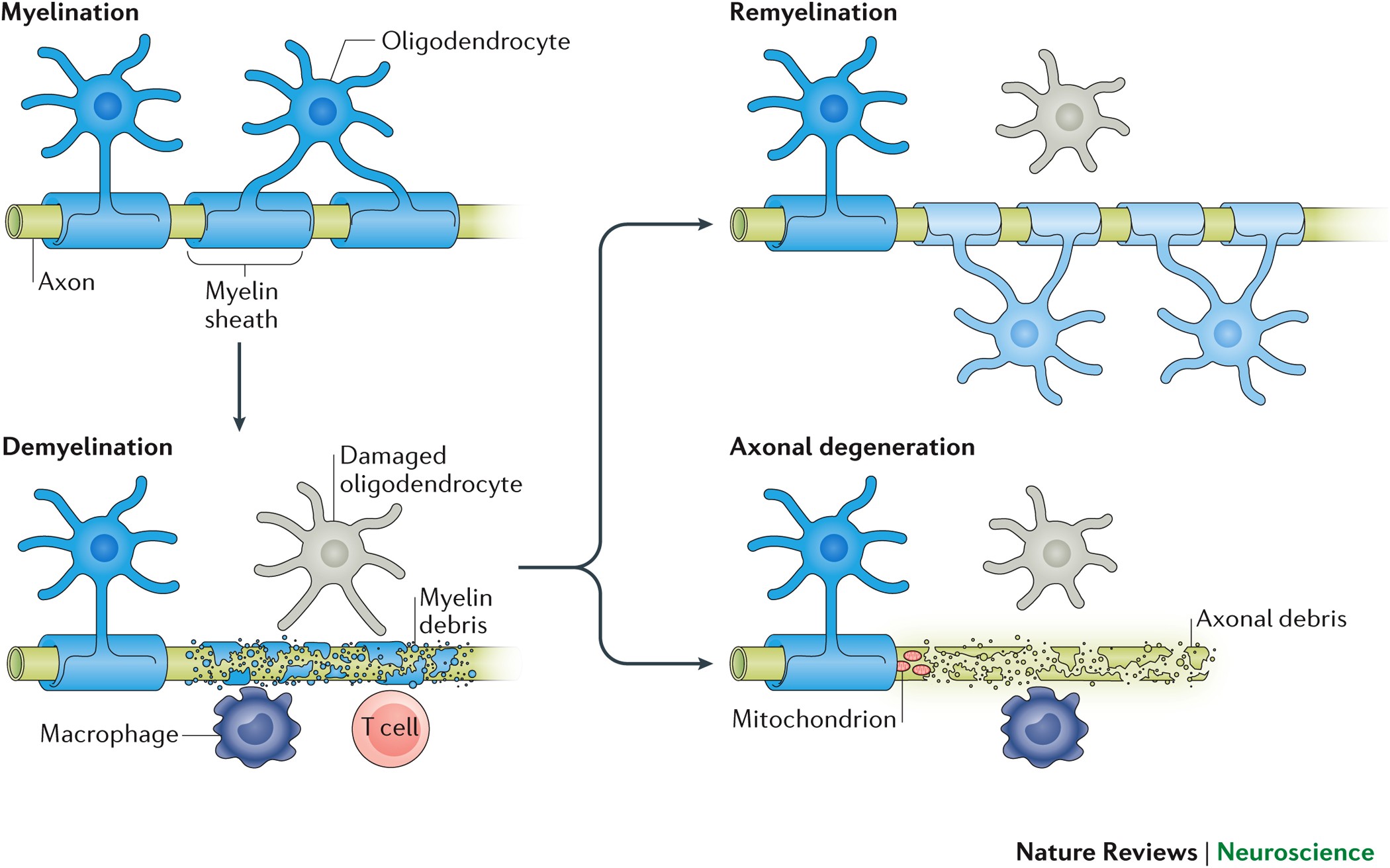 Regenerating CNS myelin — from mechanisms to experimental medicines |  Nature Reviews Neuroscience