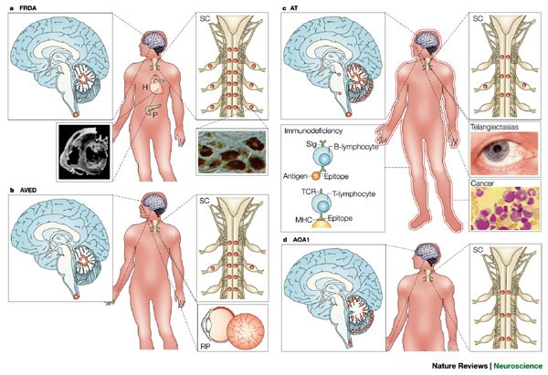 32719 PDFs  Review articles in ATAXIA