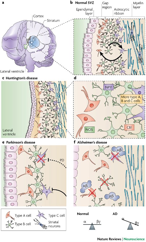 The effect of neurodegenerative diseases on the subventricular ...
