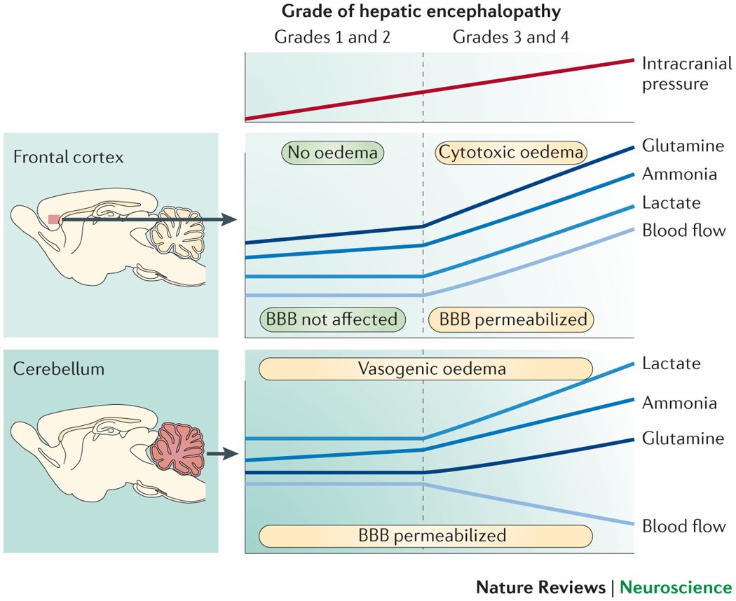 l carnitine hepatic encephalopathy Branched chain amino acids in and sarcopenia in liver cirrhosis: Evidence and uncertainties Impaired brain function improved by