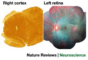 Shadows Cast by Retinal Blood Vessels Mapped in Primary Visual Cortex