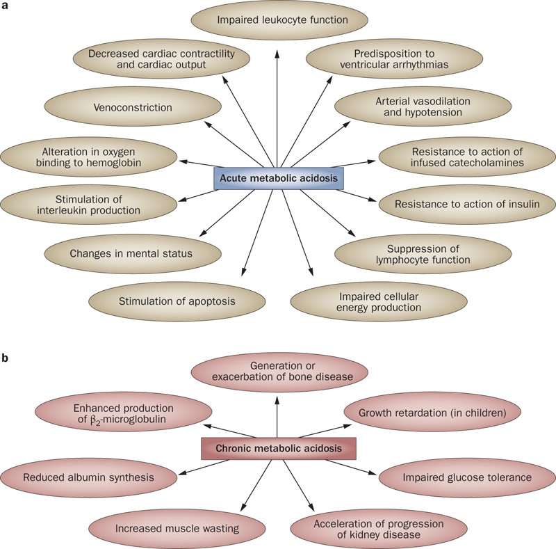 Metabolic acidosis: pathophysiology, diagnosis and management | Nature  Reviews Nephrology