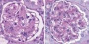 does bpc 157 help herniated disc Can BPC-157 Help With A Herniated Disc?