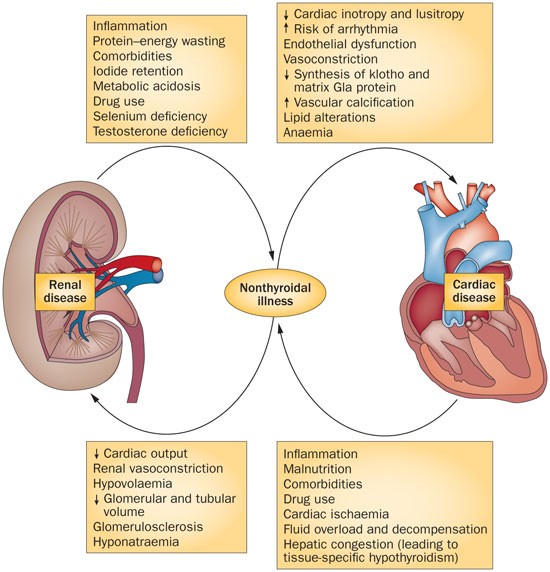Nonthyroidal Illness And The Cardiorenal Syndrome Nature Reviews