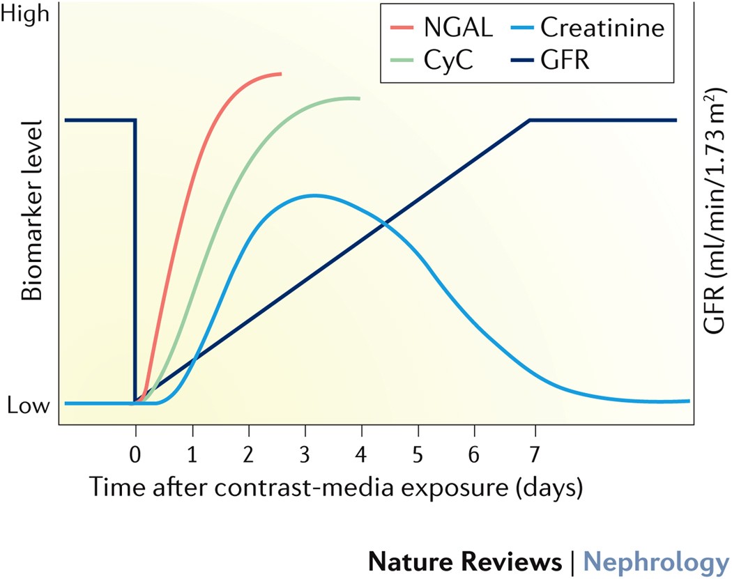 Creatinine level variation in patients subjected to contrast