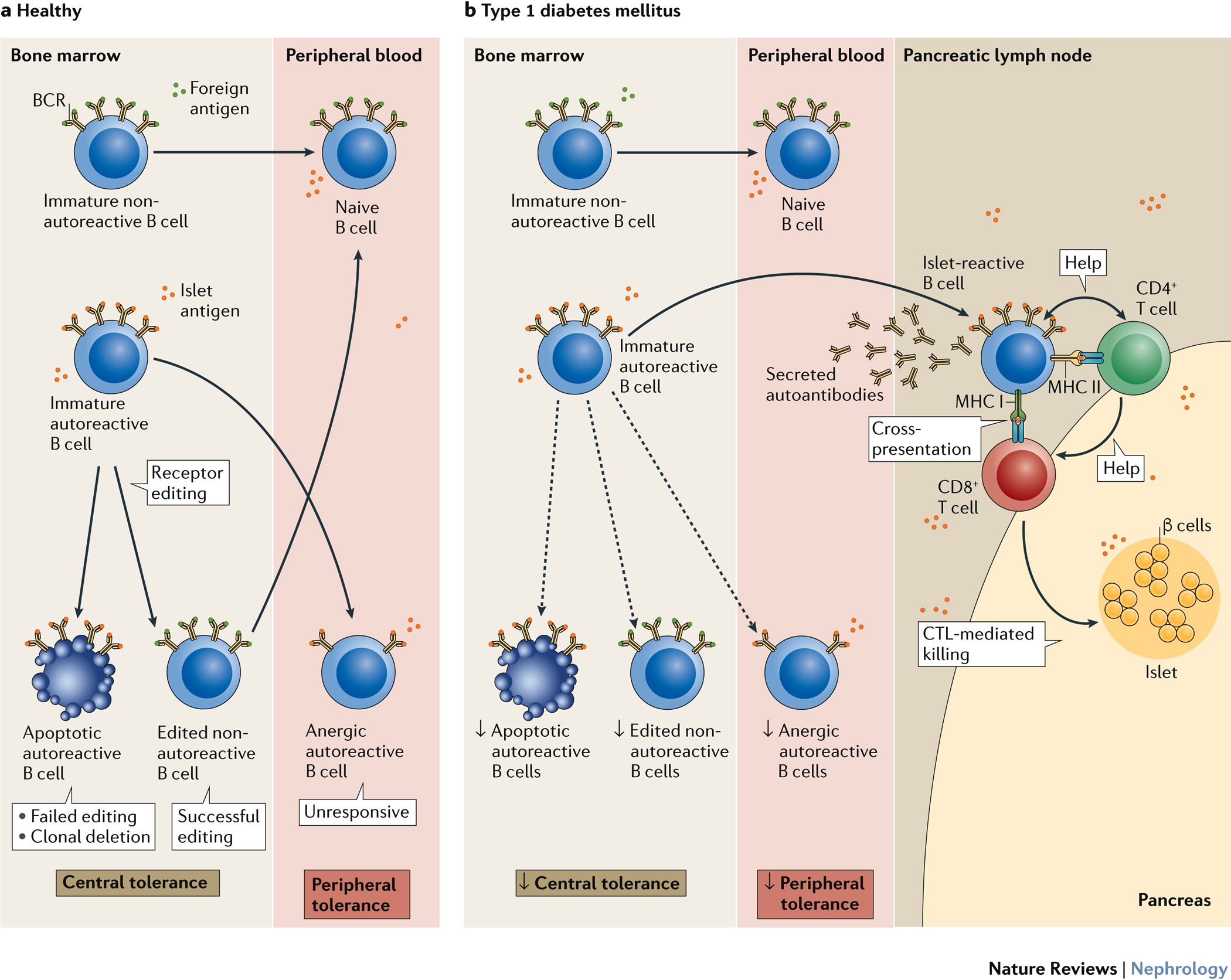 B Cells In Type 1 Diabetes Mellitus And Diabetic Kidney Disease