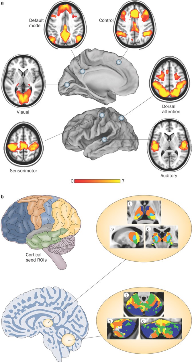 Disease And The Brain S Dark Energy Nature Reviews Neurology Disease And The Brain S Dark Energy Nature Reviews Neurology