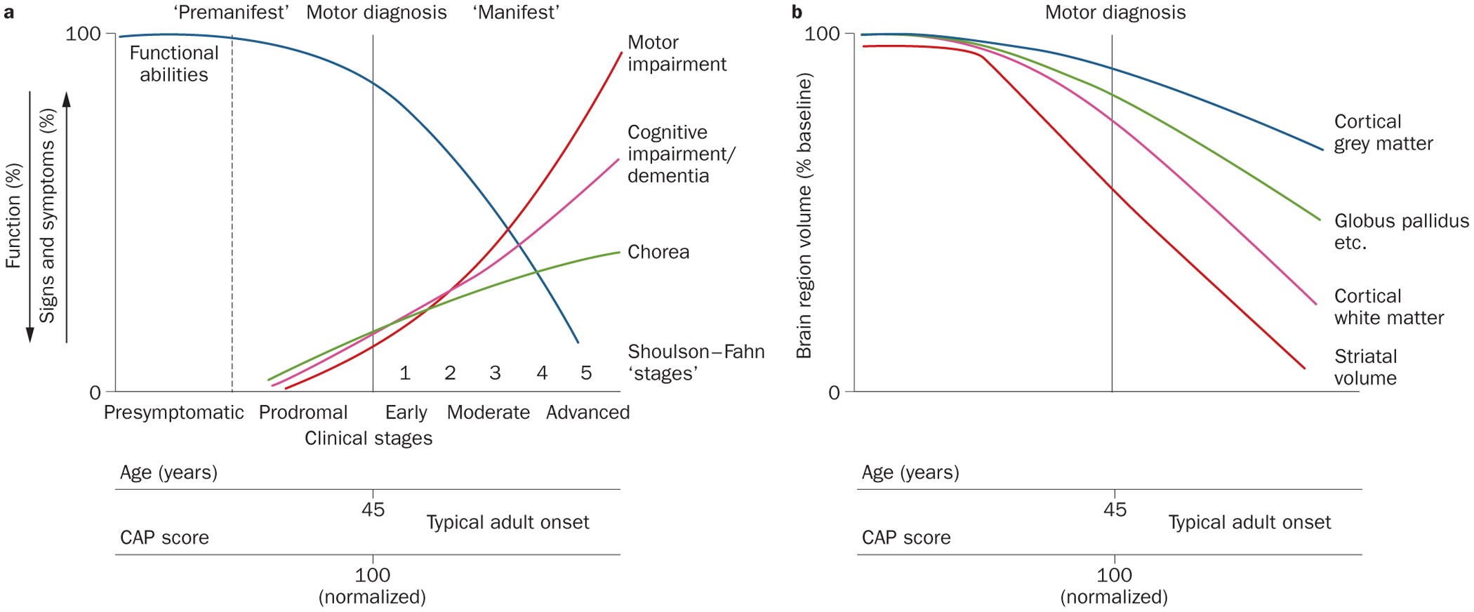 Chart showing progression of Huntington’s Disease symptoms and brain volume loss across stages
