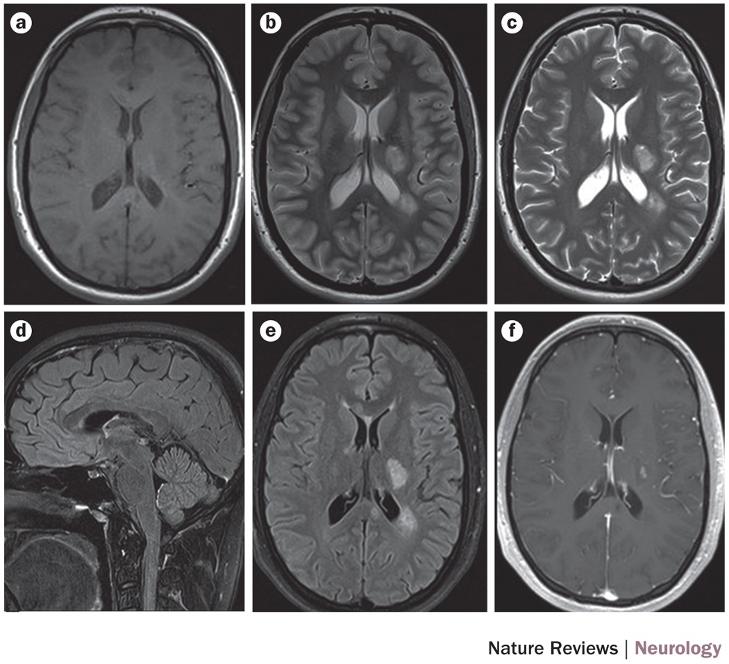 MRI Non-Magnetic Clipboards