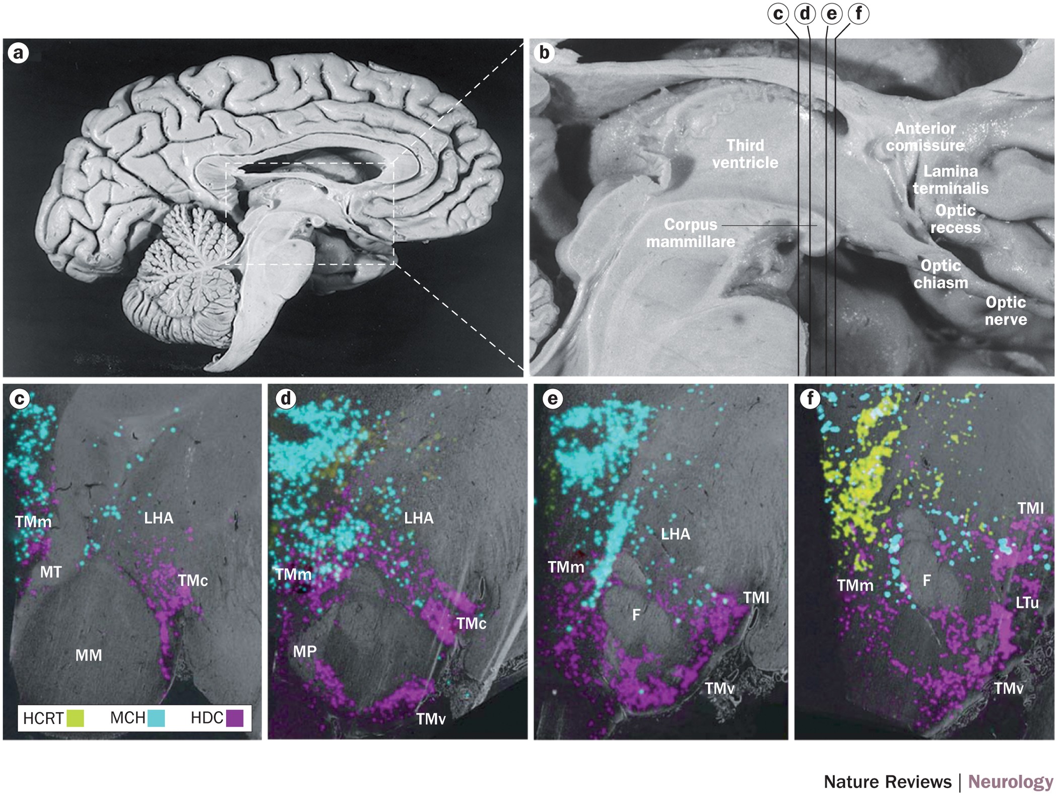Interactions of the histamine and hypocretin systems in CNS disorders |  Nature Reviews Neurology