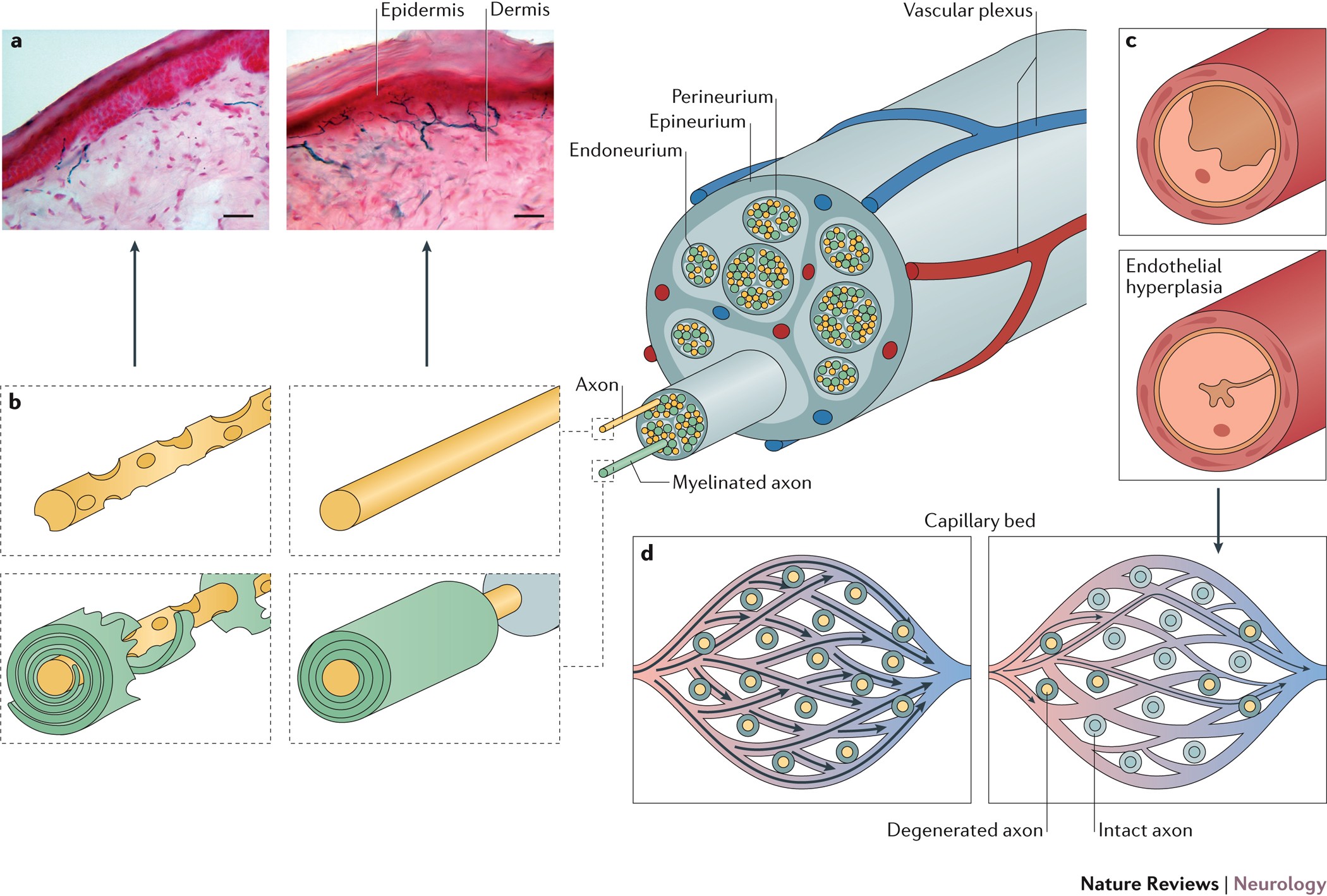 Schwann cell interactions with axons and microvessels in diabetic  neuropathy | Nature Reviews Neurology