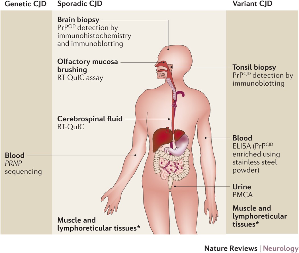 Detection of Prions in a Cadaver for Anatomical Practice