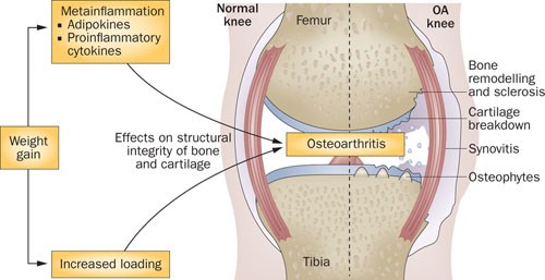 What Causes Knee Joint Stress