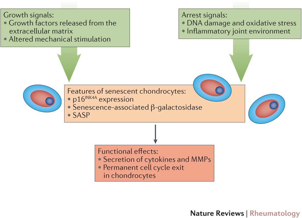 Ageing and the pathogenesis of osteoarthritis | Nature Reviews Rheumatology