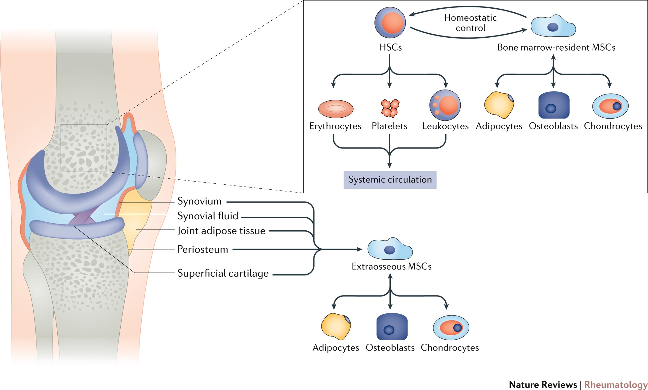 Why is Weight Loss Important for the Resident With Osteoarthritis