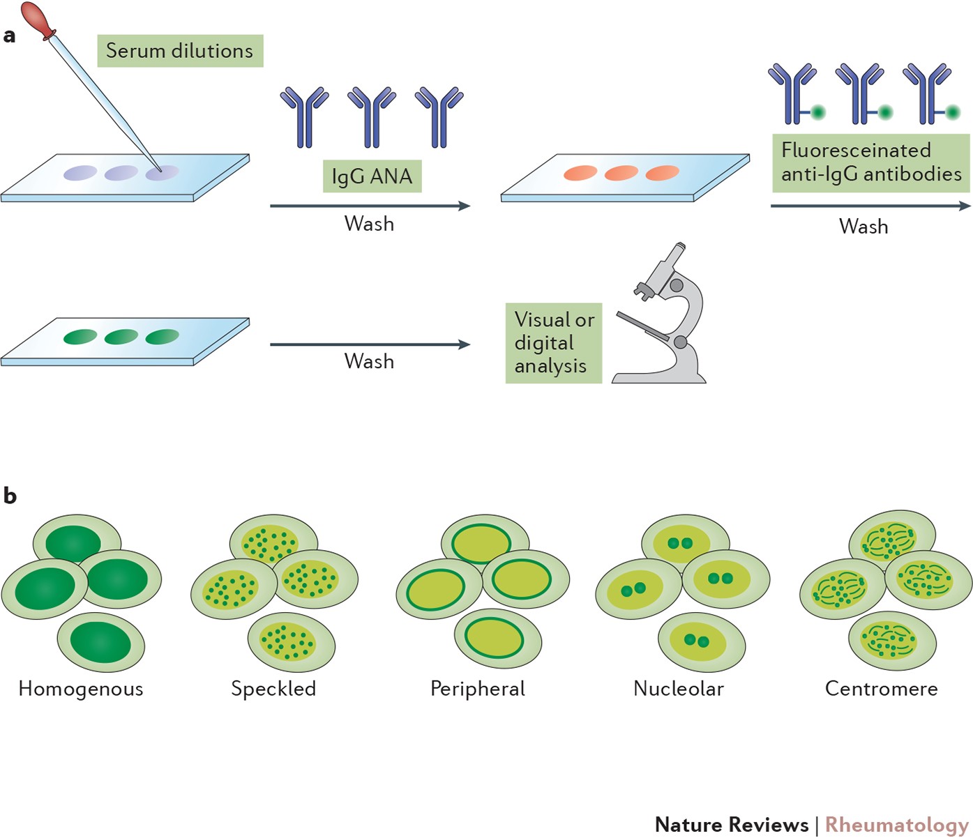 Antinuclear antibody testing — misunderstood or misbegotten? | Nature  Reviews Rheumatology