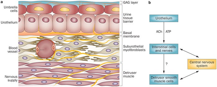 Intravesical treatments of bladder pain syndrome/interstitial cystitis |  Nature Reviews Urology