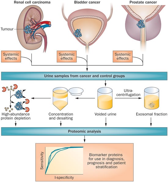 urine biomarker test for prostate cancer